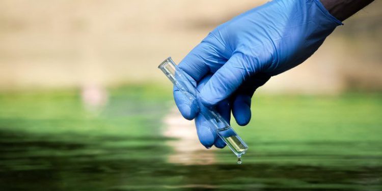 Cholera Outbreak: NCDC on Alert, Lagos Implements Health Protocols